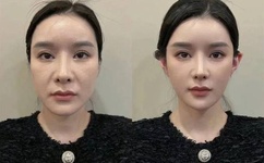 19岁最强RAPPER老狼